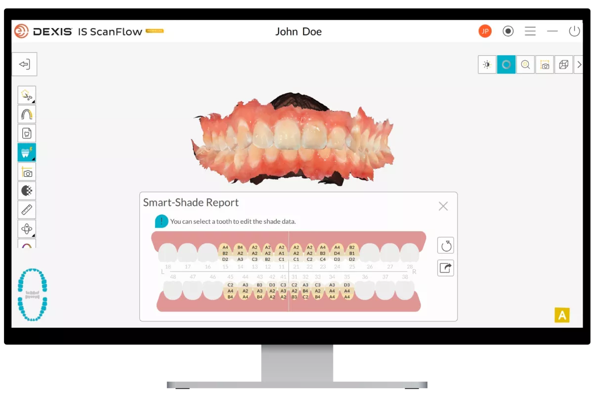 DEXIS-IS-ScanFlow-smart-shade